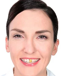 zahnlack-gold-mw-109804-2